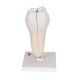 Radacina molar inferior cu prez cavitatilor (3B)