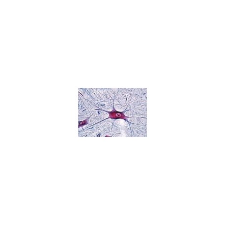 Sectiuni microscopice sistemul nervos BSM15
