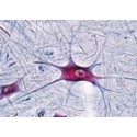 Sectiuni microscopice sistemul nervos BSM15