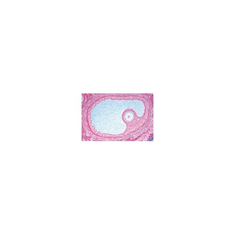 Sectiuni microscopice sistemul genital