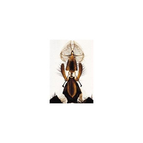Sectiuni microscopice artropoda